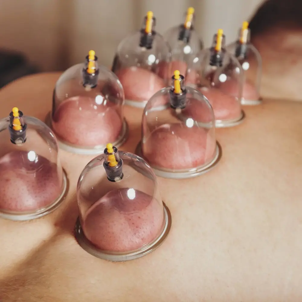 Special Therapy (Oil/Dry)<br>Cupping + Massage Special Therapy (Oil/Dry)<br>Cupping + Massage